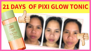 Pixi Glow Tonic Review: Is It Worth It In The Philippines?